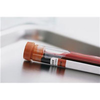 B型肝炎は血液から感染する